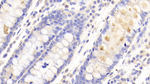 CHN2 Polyclonal Antibody