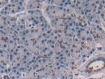 IL-28A Polyclonal Antibody