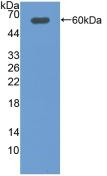 DIO2 Antibody in Western Blot (WB)