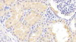 FLRT3 Antibody in Immunohistochemistry (Paraffin) (IHC (P))