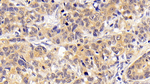 CCL16 Antibody in Immunohistochemistry (Paraffin) (IHC (P))