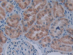 SIVA1 Polyclonal Antibody