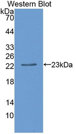 SIVA1 Antibody in Western Blot (WB)