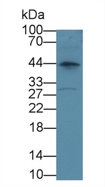 HACD1 Antibody in Western Blot (WB)