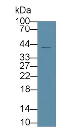 HACD1 Polyclonal Antibody