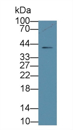 HACD1 Antibody in Western Blot (WB)