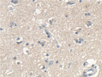 SCARA5 Polyclonal Antibody