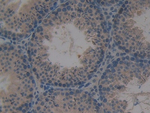 PRKD1 Polyclonal Antibody