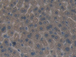 PRKD1 Antibody in Immunohistochemistry (Paraffin) (IHC (P))