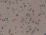 PRKD1 Antibody in Immunohistochemistry (Paraffin) (IHC (P))