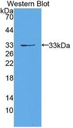 PRKD1 Antibody in Western Blot (WB)