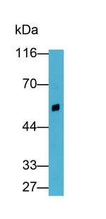 Renin Antibody in Western Blot (WB)