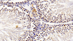 COMP Polyclonal Antibody