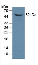 FKBP5 Antibody in Western Blot (WB)