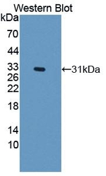 NOX3 Antibody in Western Blot (WB)