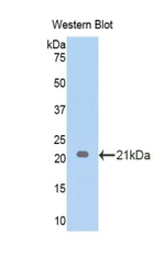 Endothelin 1 Antibody in Western Blot (WB)