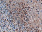 CCL3L1 Polyclonal Antibody