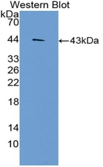 CCL3L1 Antibody in Western Blot (WB)
