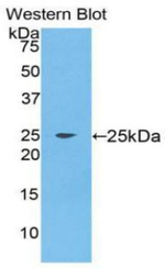 FGF9 Antibody in Western Blot (WB)