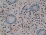 MCP-4 Antibody in Immunohistochemistry (Paraffin) (IHC (P))