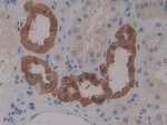 MCP-4 Antibody in Immunohistochemistry (Paraffin) (IHC (P))