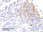 IL1RA Antibody in Immunohistochemistry (Paraffin) (IHC (P))