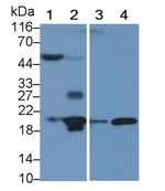 IL1RA Antibody in Western Blot (WB)