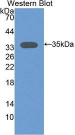 PKC alpha Antibody in Western Blot (WB)