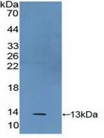 S100A2 Antibody in Western Blot (WB)