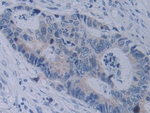 Neuropilin 2 Polyclonal Antibody
