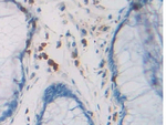 RNASE8 Polyclonal Antibody