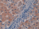 MYL9 Antibody in Immunohistochemistry (Paraffin) (IHC (P))