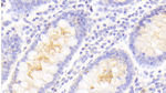 PLIN4 Polyclonal Antibody