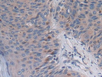 PCSK5 Polyclonal Antibody