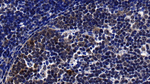 LECT2 Polyclonal Antibody