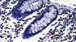 LECT2 Antibody in Immunohistochemistry (Paraffin) (IHC (P))