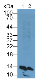FABP1 Antibody in Western Blot (WB)