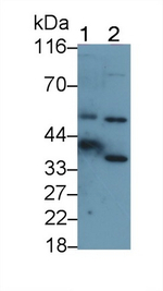 Carbonic Anhydrase VI Antibody in Western Blot (WB)