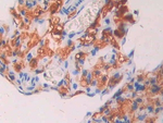 CA7 Antibody in Immunohistochemistry (Paraffin) (IHC (P))