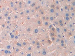 CA7 Antibody in Immunohistochemistry (Paraffin) (IHC (P))