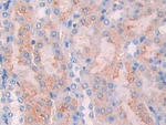 CA7 Antibody in Immunohistochemistry (Paraffin) (IHC (P))