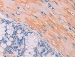 CA7 Antibody in Immunohistochemistry (Paraffin) (IHC (P))