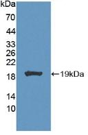 CA7 Antibody in Western Blot (WB)