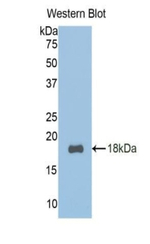 TCF20 Polyclonal Antibody