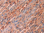 Carbonic Anhydrase XII Antibody in Immunohistochemistry (Paraffin) (IHC (P))