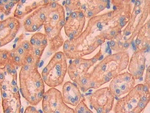 Carbonic Anhydrase XII Antibody in Immunohistochemistry (Paraffin) (IHC (P))