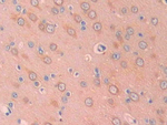 Carbonic Anhydrase XII Antibody in Immunohistochemistry (Paraffin) (IHC (P))