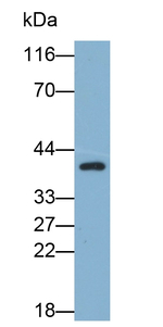Carbonic Anhydrase XII Antibody in Western Blot (WB)