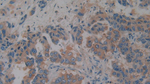 AZGP1 Antibody in Immunohistochemistry (Paraffin) (IHC (P))