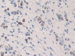 KIR2DL2 Antibody in Immunohistochemistry (Paraffin) (IHC (P))